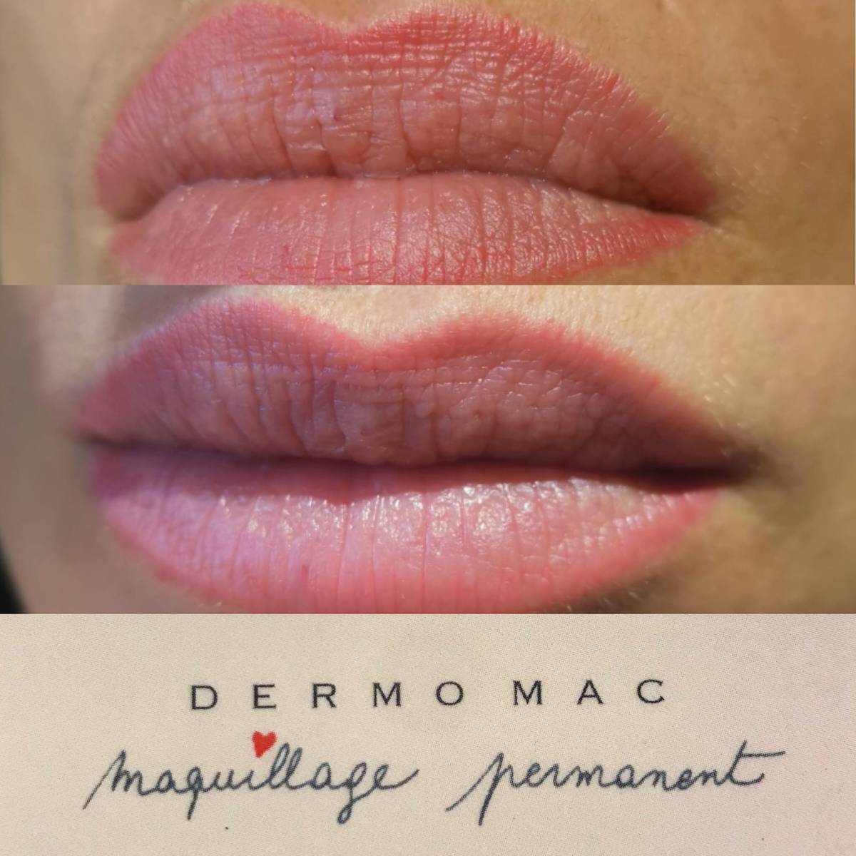 tatouage des lèvres Dermomac