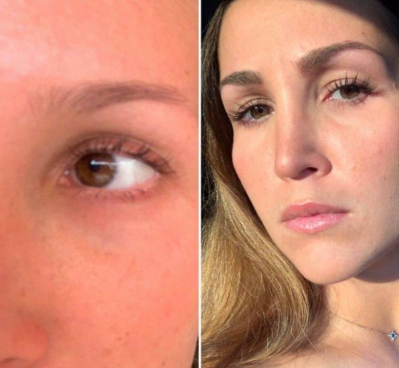 Tatouage des sourcils Dermomac