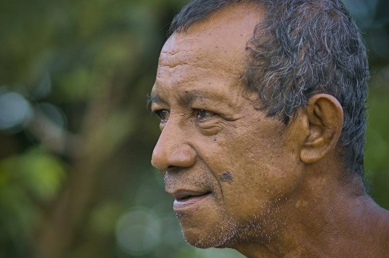 Puis-je porter un chapeau après une greffe de cheveux pendant la période de récupération à Nice